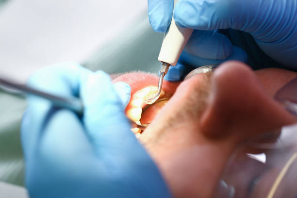 Best Dentist for Tooth Abscess  in Duncan, SC