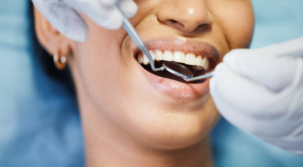 Best Chipped Tooth Repair Near Me  in Duncan, SC